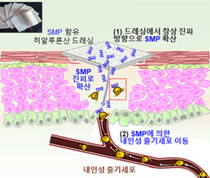 아주대학교 김문석 교수팀, 내인성 줄기세포 활용 피부 상처 치료 방안... - 뉴스 썸네일 이미지