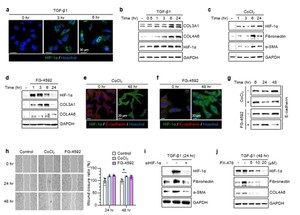 제주대학교, "폐가 굳는 난치병, 새로운 치료 길이 열린다" - 뉴스 썸네일 이미지
